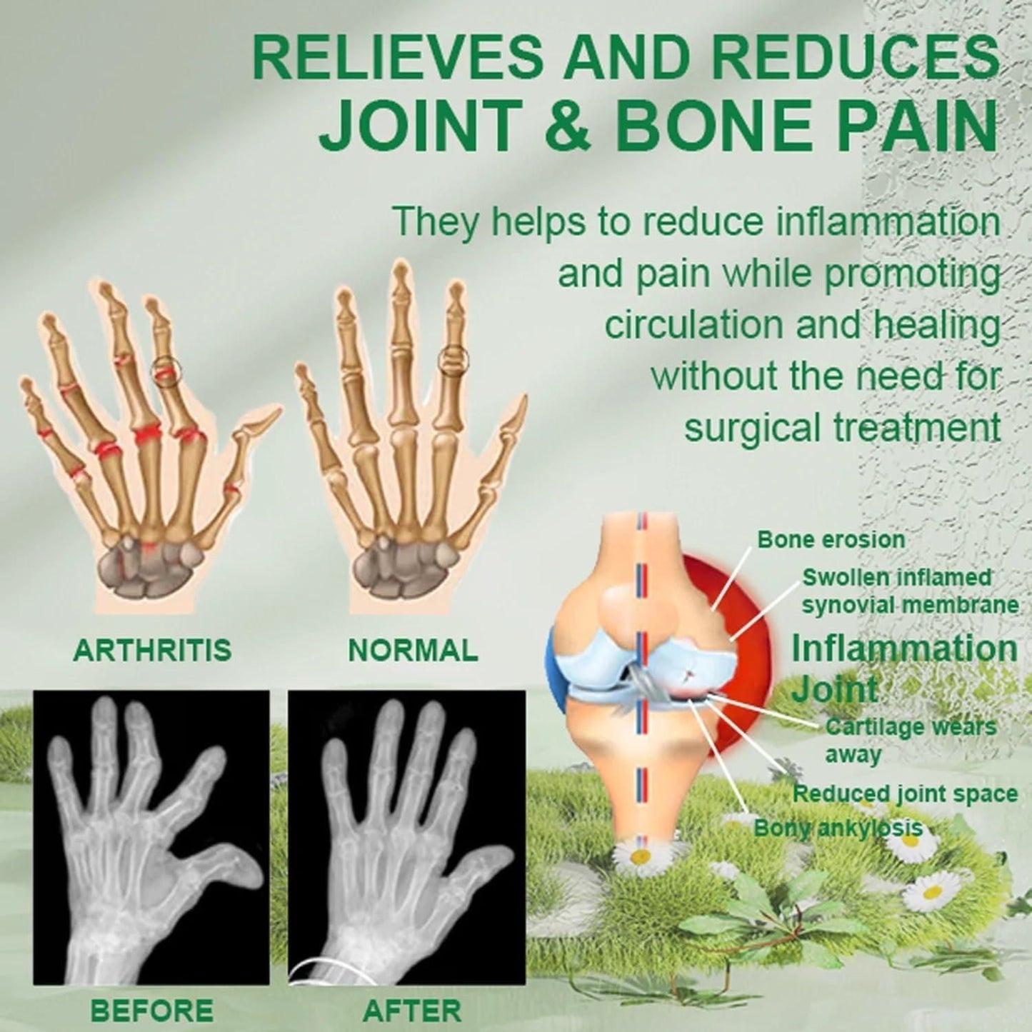 Bee Venom Joint and Bone Therapy Cream | đ„ BUY 1 GET 1 FREEđ„|