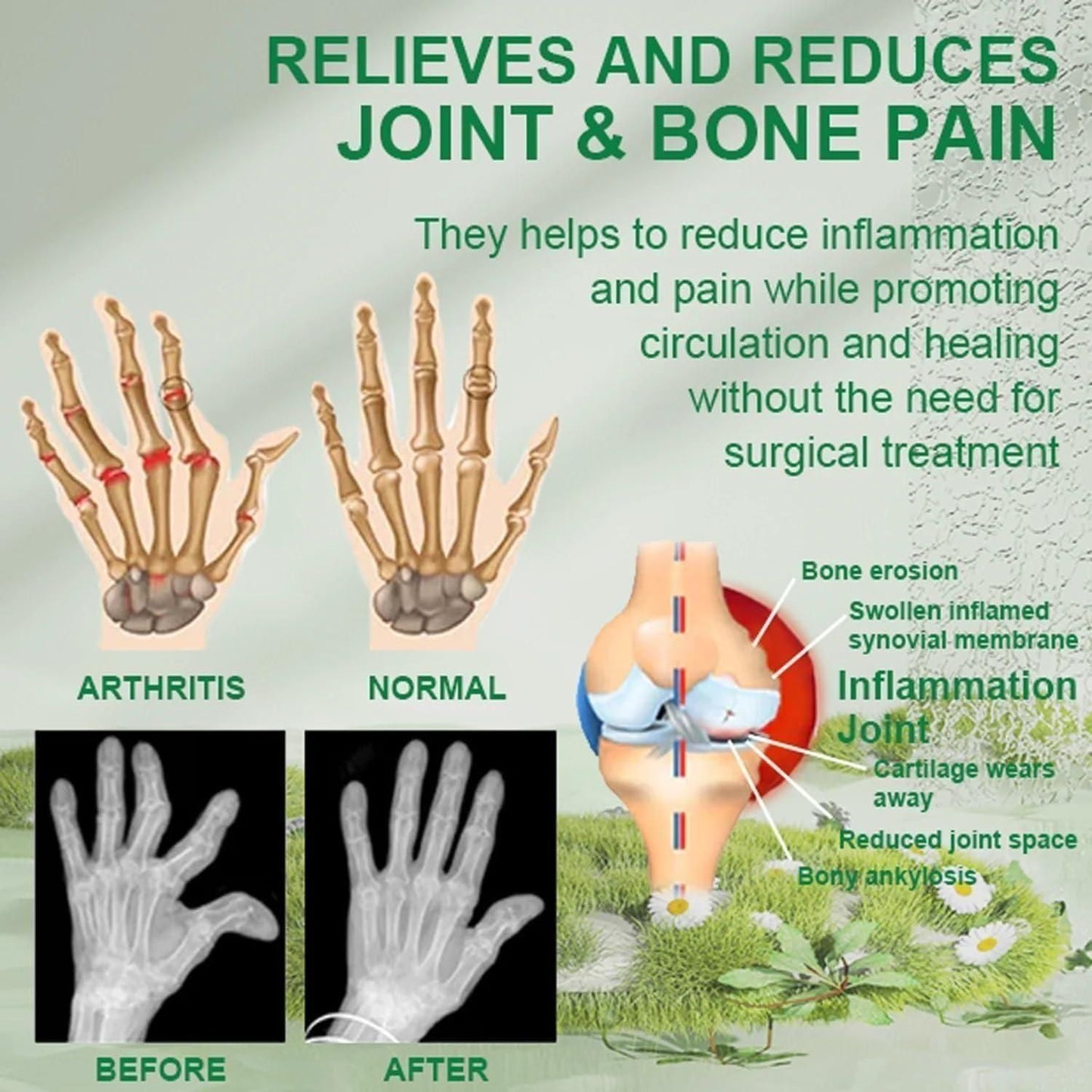 Bee Venom Joint and Bone Therapy Cream | đ„ BUY 1 GET 1 FREEđ„|